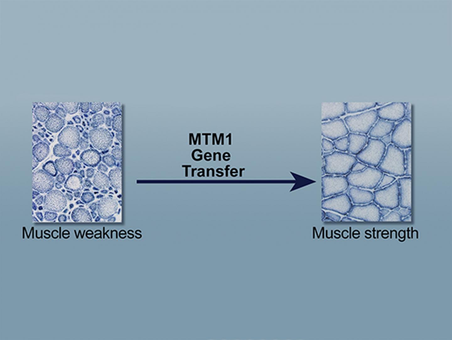 Schematic of Gene Therapy for Inherited Muscle Disorder Myotubular Myopathy