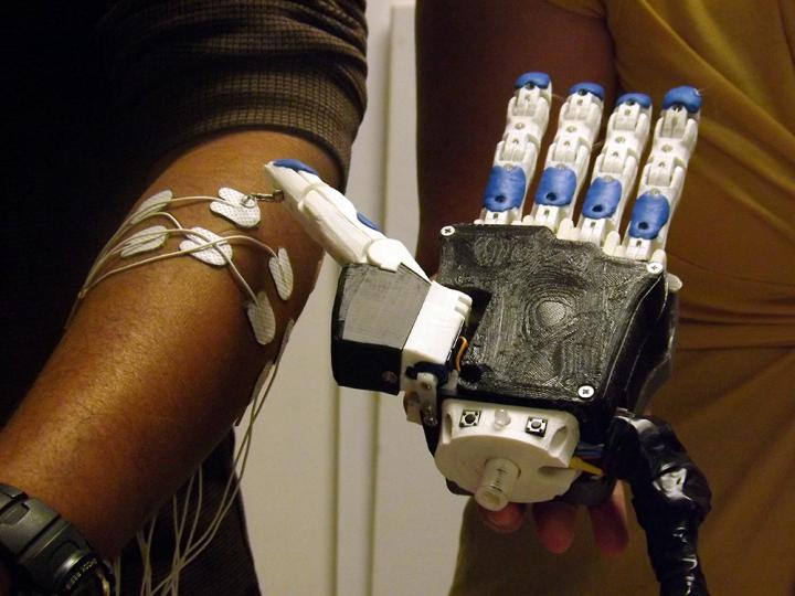 3-D Printed Prosthetic Hand