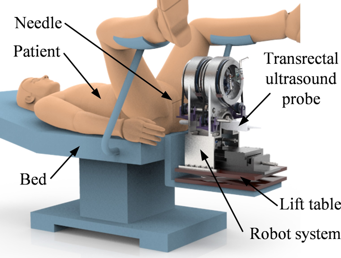 Chinese researchers report integrated robot system for ultrasound-guided prostate percutaneous intervention