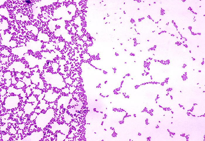 Streptococcus Mutans