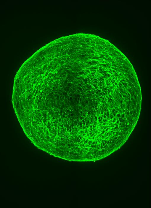 A ball of neuroblastoma cells forming mature nerves after drug treatment