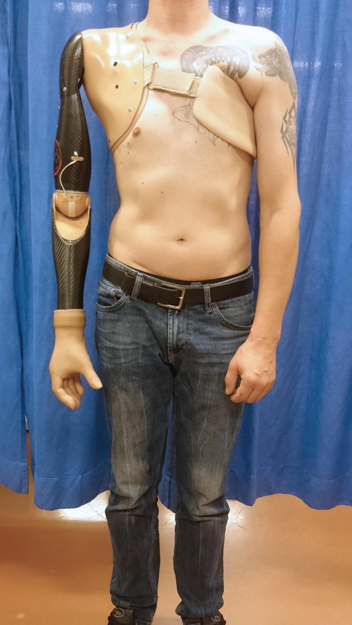 Prosthetic Technology in the Study