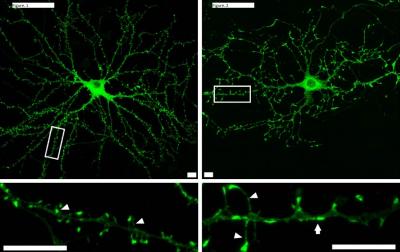Synapses with and without MK2/3
