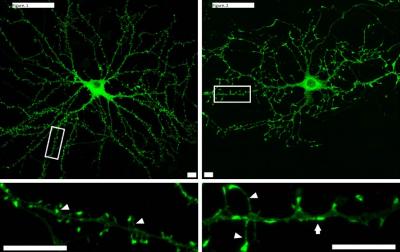 Synapses with and without MK2/3