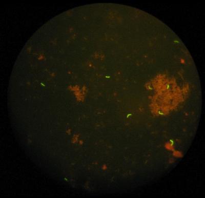 How to Recognize Resistant Tuberculosis?