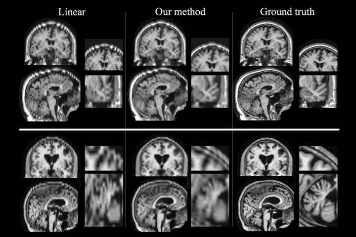 Better MRI