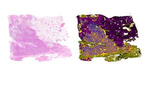 The image shows how the algorithm processes the typically coloured tissue section (left) and creates a map in which different types of tissue can be seen in different colours