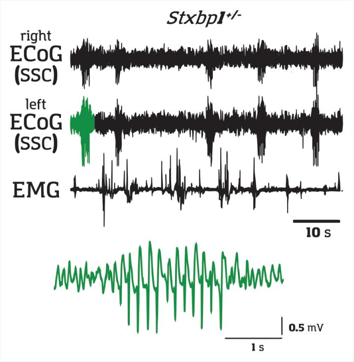 Spike-Wave Discharges in the Somatosensory Cortex of <i>Stxbp1+/?</i> Mice