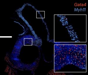 Cells in the aorta expressing the protein Gata4,