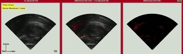 A Dual Imaging Approach May Improve Diagnosis and Monitoring of Prostate Cancer (2 of 2)