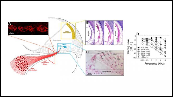 Hair Cell Loss Causes Age-Related Hearing Loss