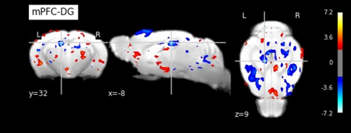 Tob遺伝子を欠失させたマウスの海馬と前頭前野のMRI画像
