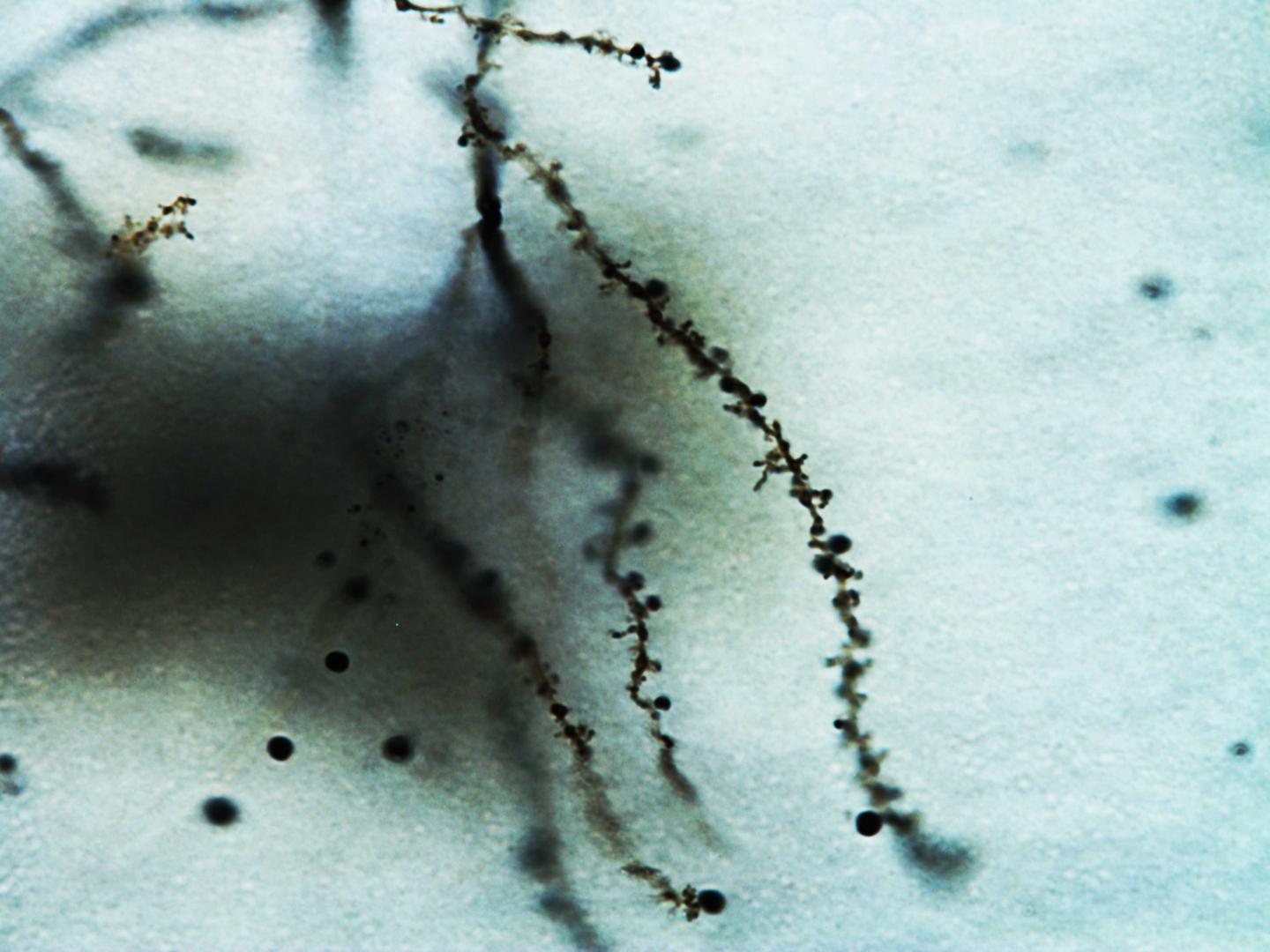 An Abnormal Dendrite of a Neuron from FXS Mice