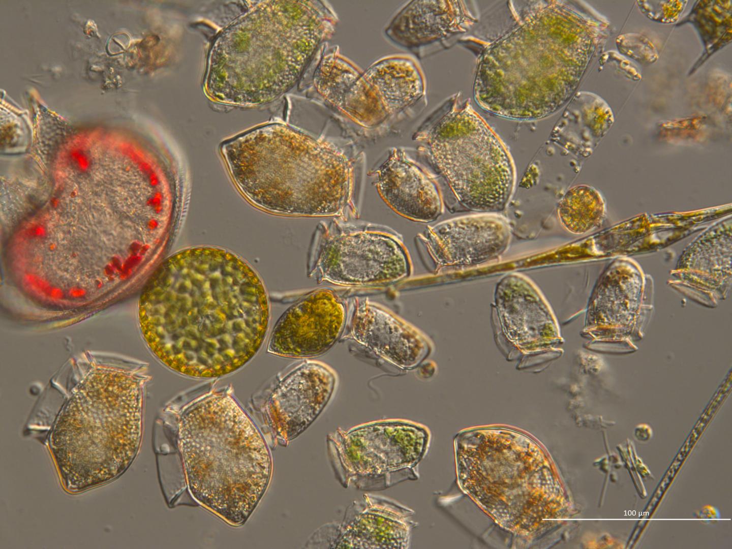 Dinoflagellates and Diatoms
