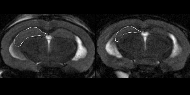 CAPON Overexpression