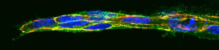 Blood Vessel Growth Differs Between Tissues, Opening Door to Tissue-Specific Therapy (3 of 4)