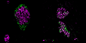 Comparison of mice pancreatic islets with and without microexon splicing regulation