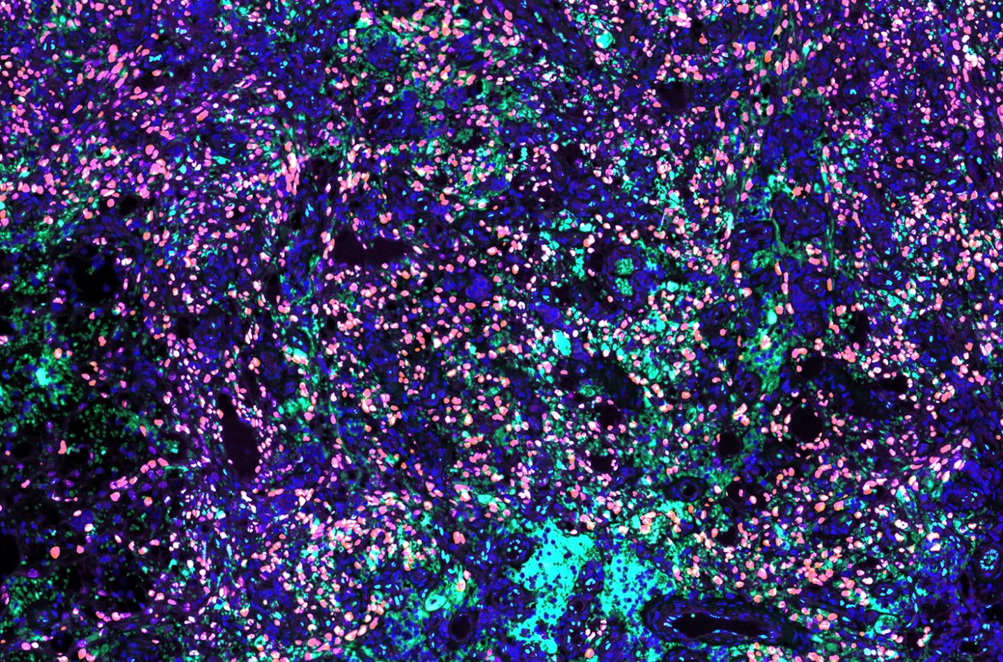 Multiplex Immunohistochemistry