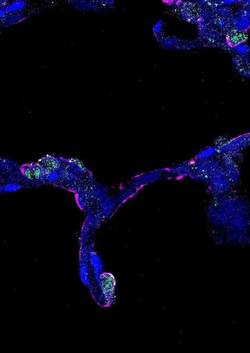 Mapping lung development after birth - 2