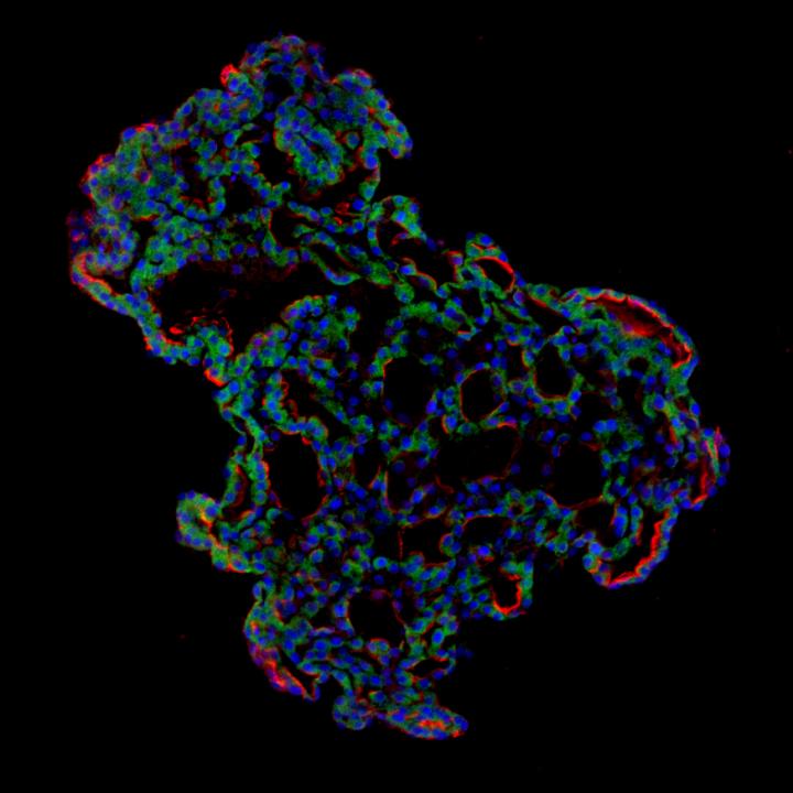 3D human lung alveolar organoid