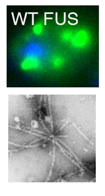 Mutated Protein in Lou Gehrig’s Disease
