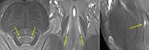 Locus coeruleus in 7T scan