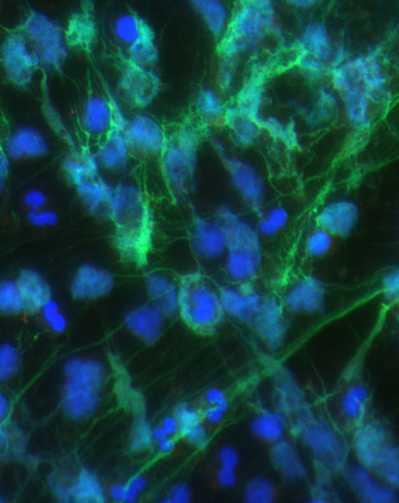 Human Neutrophils Release NETs in Response to Motile <i>P. Aeruginosa</i>