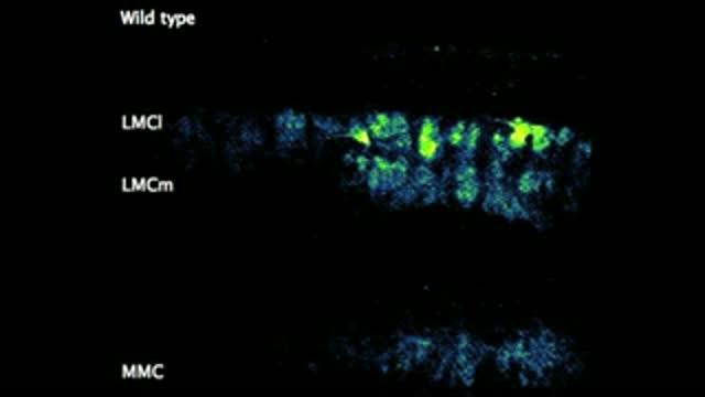 Salk Scientists See Motor Neurons 'Walking' in Real Time