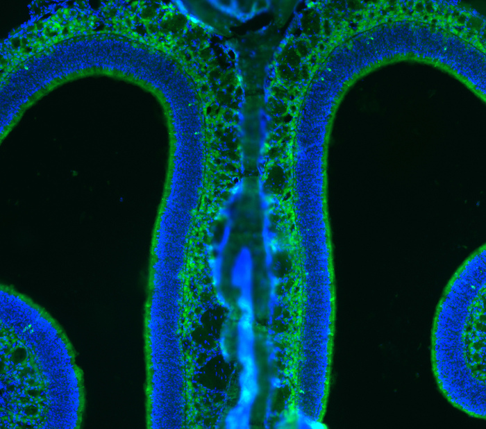 Olfactory neurons adapt to the surrounding en | EurekAlert!