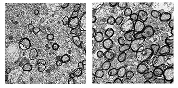 Cimetidine Promotes Recovery from White Matter Injury after Hypoxia-Ischemia