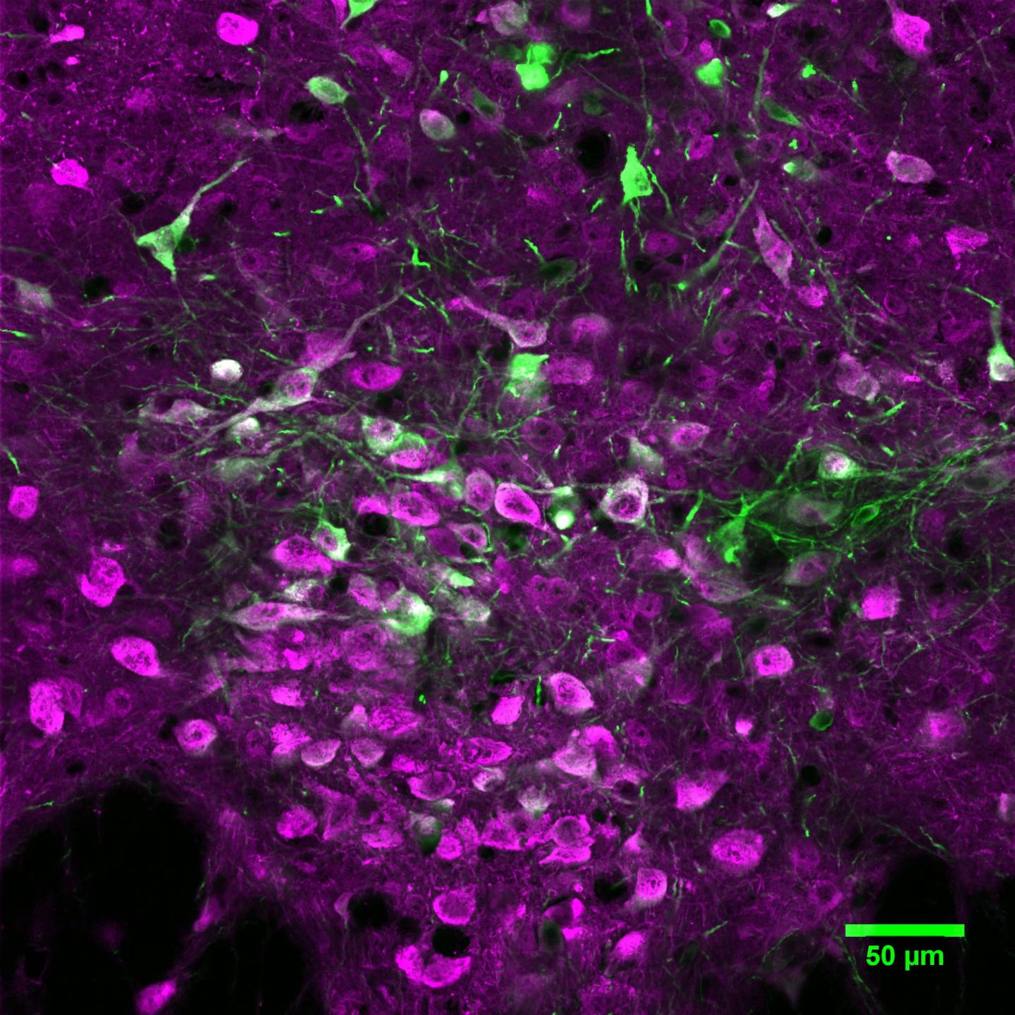 Image Microphotography of Serotonin-producing Neurons