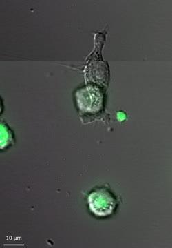 Phagocyte Eating Dying Cells