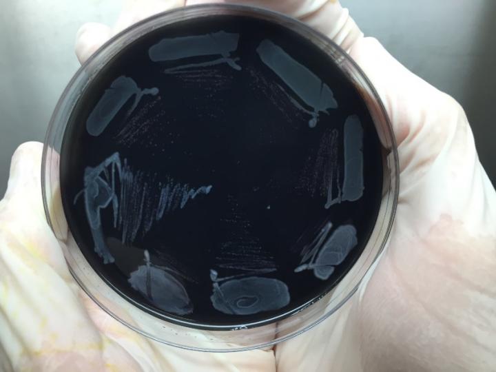 <em>Legionella</em> Strains