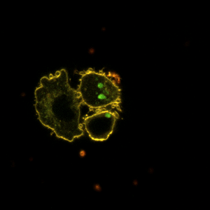 Circadian clocks in human pancreatic islets control the lipid membrane fluidity.