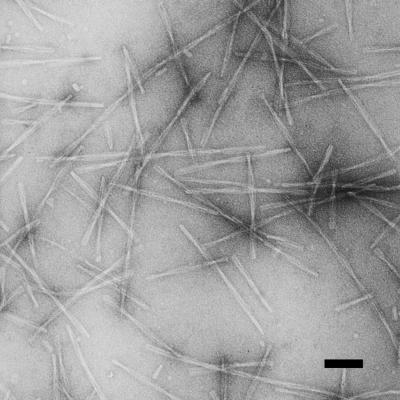 Amyloid Fibrils