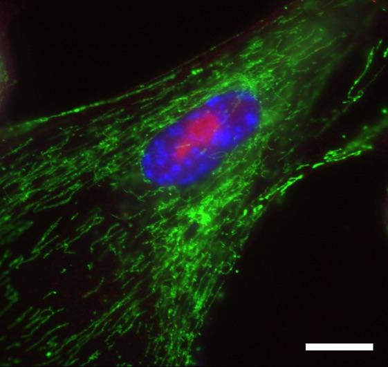 Senescent Fibroblast Cells