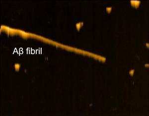 HS-AFM observation of Aβ fibril with 4396C antibody