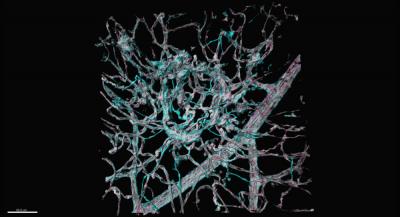 Stained Retinal Vasculature Reconstruction 