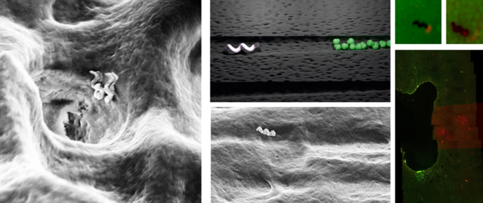 Tiny bots that can deep clean teeth