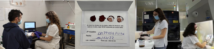 Left to right: REDAN La Mina, dried blood spot, Microbiology Service (LCMN) at Germans Trias Hospital