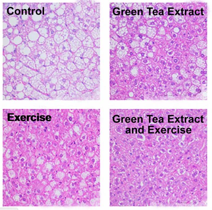 Fatty Liver