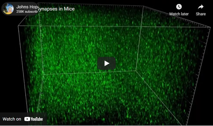 Mouse brain synapses