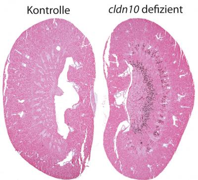 New Insights into Salt Transport in the Kidney