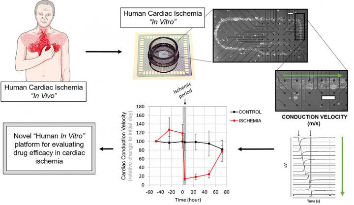 A Human in vitro Platform for Evaluating Pharmacologic Strategies