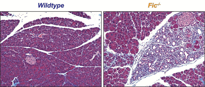 UTSW researchers identify key player in cellular response to stress