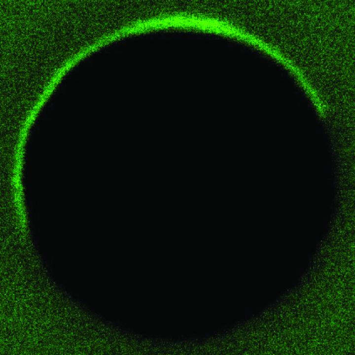 Tagged Proteins Located on a Vesicle Membrane