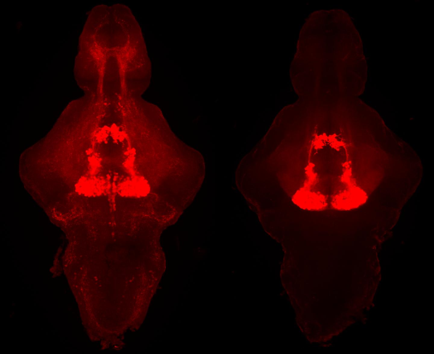 Serotonin in the Zebrafish Brain