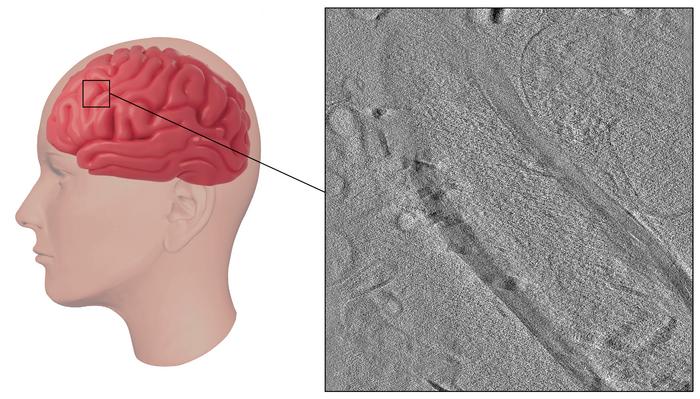 Using Ion Beams to Improve Brain Microscopy