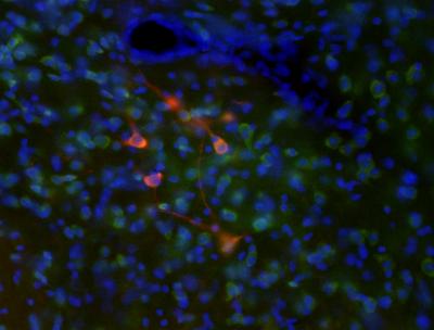 Dopaminergic Neurons