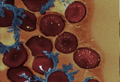 Nanoparticle Switches Turn Blood Clotting On and Off